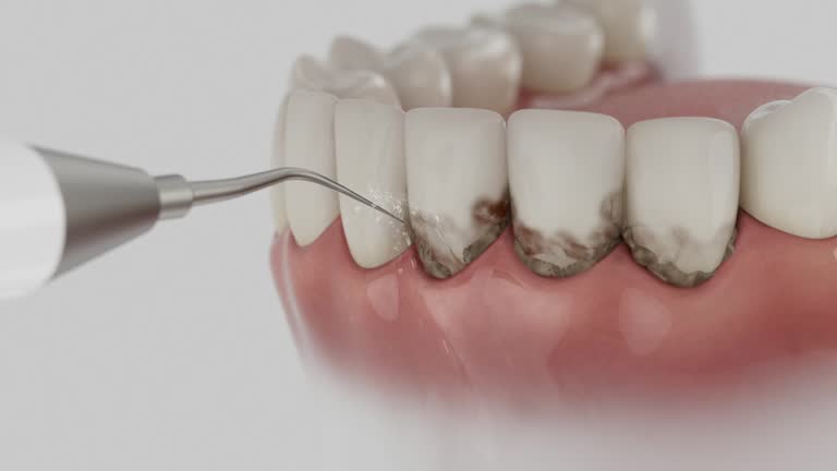 Trusted Root Canal Treatment service in Morgan Hill, PA - Dentist Open Now